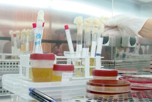 Ialomița luptă zadarnic împotriva cancerului de col uterin