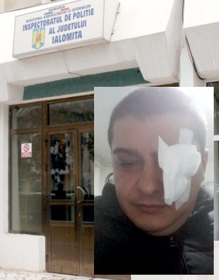 Bătut de un polițist într-o benzinărie