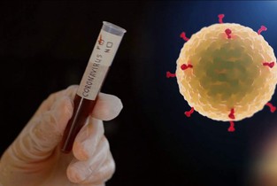 Al patrulea ialomițean ucis de noul Coronavirus