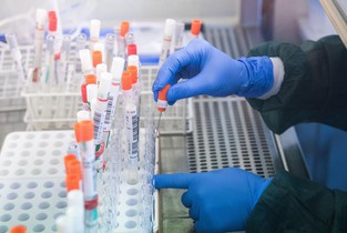 Spitalul Județean de Urgență Slobozia poate efectua teste pentru depistarea noului Coronavirus (SARS-CoV-2)