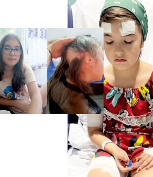 Mutilată de câini, Andreea are nevoie de sprijinul comunității!