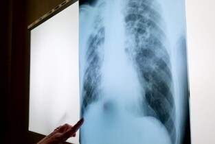 Interpretări radiologice prin telemedicină, la Spitalul Județean de Urgență Slobozia