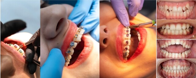 Clinica Dentară Dr. Ardeleanu Slobozia-aparate dentare și ortodonție modernă în Cartierul Tineretului