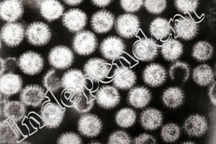Un singur caz de infecție cu Rotavirus recunoscut oficial la Spitalul de Urgență Slobozia 
